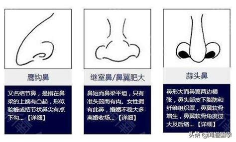 鼻子受傷面相|鼻相分析10款｜鼻樑有節及橫紋、豬膽鼻、鼻頭下垂代 